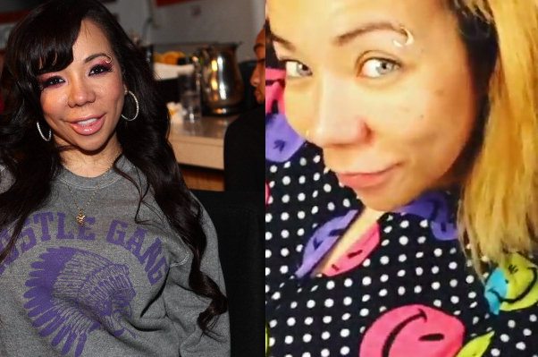 Tameka "Tiny" Harris underwent medical procedure to change her eye color. 